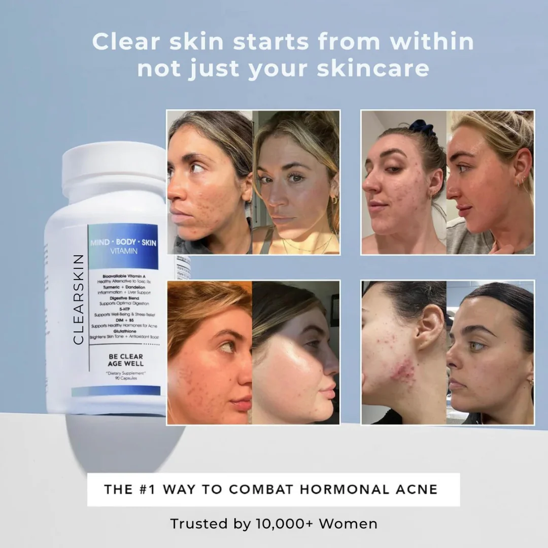 ClearSkin: Hormonal Acne Supplement For Women - Image 2