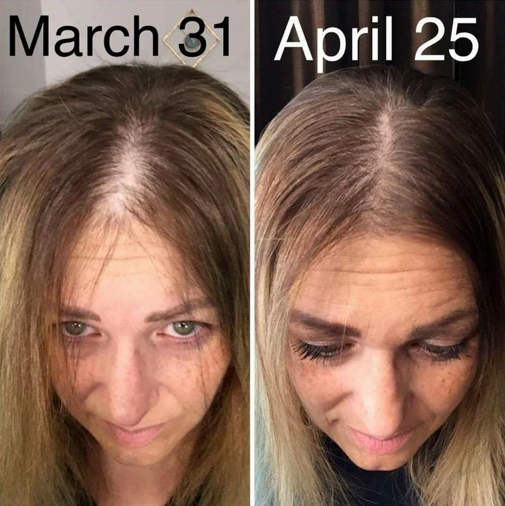 Hair Growth Accelerator - with Lustriva® - Image 7