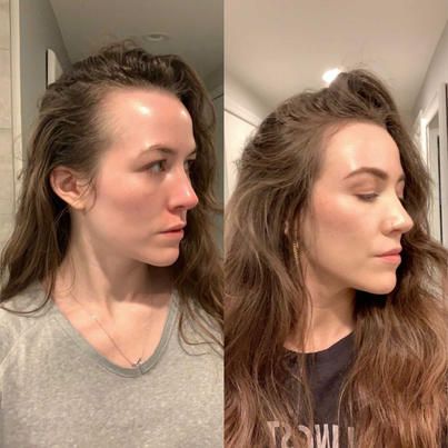 Hair Growth Accelerator - with Lustriva® - Image 8