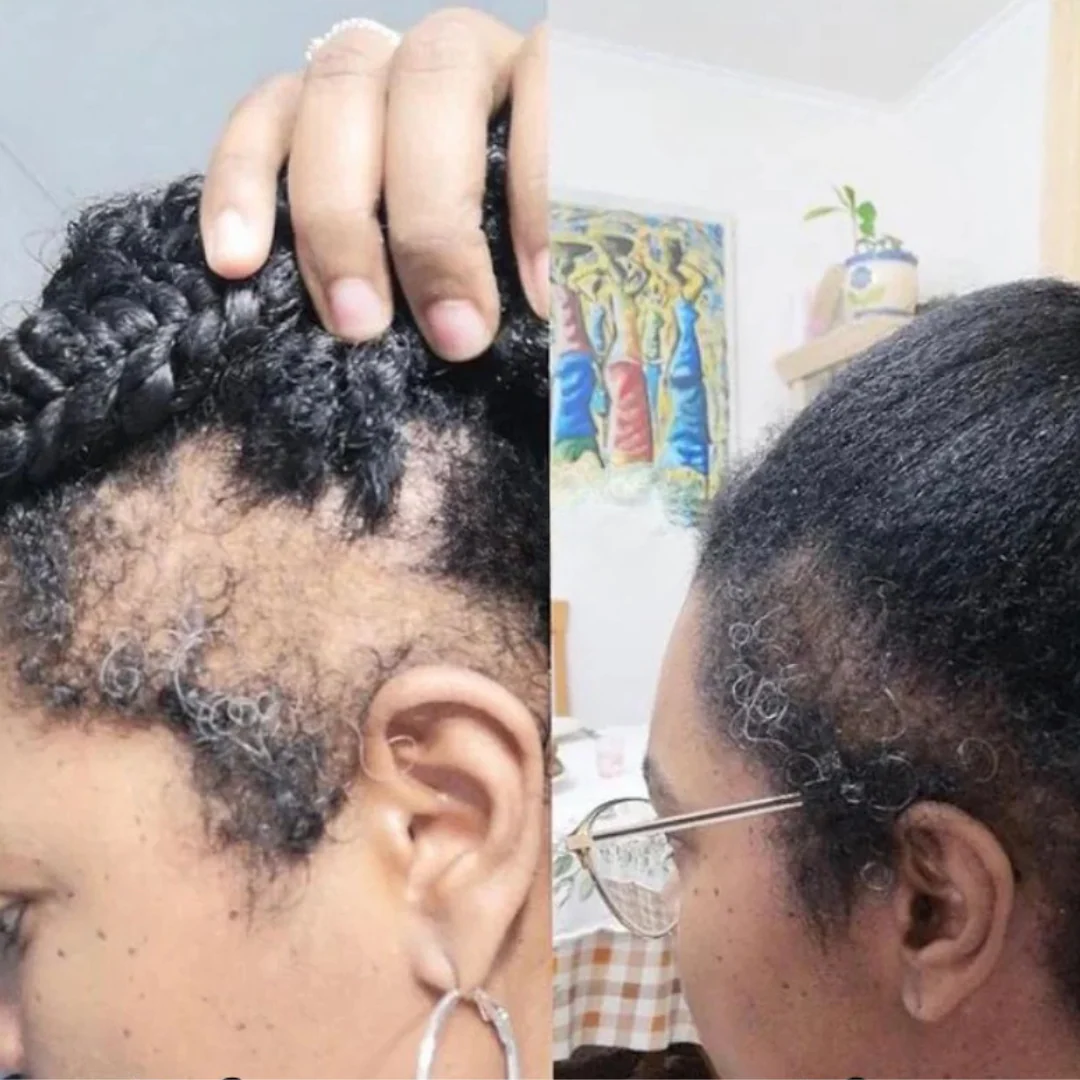 Root Revive - Edge & Hair Growth Capsules - Image 3