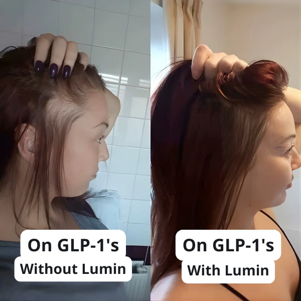 GLP Root Revive - Image 4