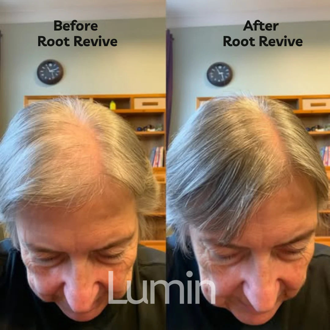 Root Revive - Image 2