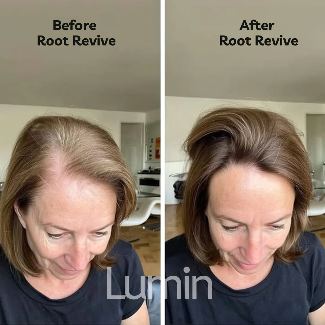 Root Revive - Image 3