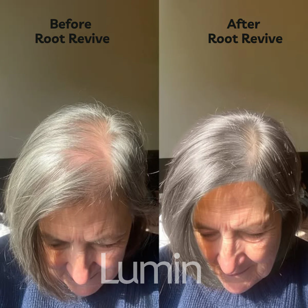 Root Revive - Image 4